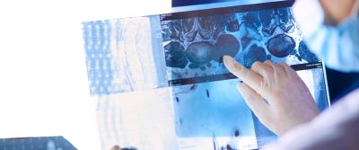 International Private Health Insurance