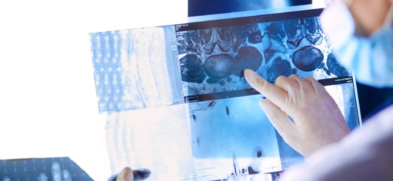 International Private Health Insurance